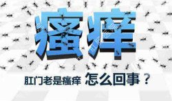 肛門(mén)瘙癢治不好嗎？先檢查病因就好辦！